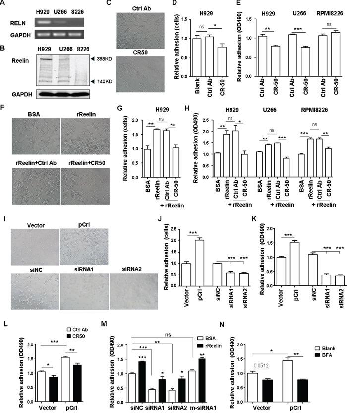 https://cdn.ncbi.nlm.nih.gov/pmc/blobs/2a7e/4891088/8bed5d8f0b2b/oncotarget-07-09844-g002.jpg