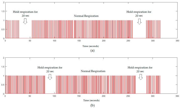 https://cdn.ncbi.nlm.nih.gov/pmc/blobs/2a7e/5876730/acb4cf767a4e/sensors-18-00920-g011.jpg