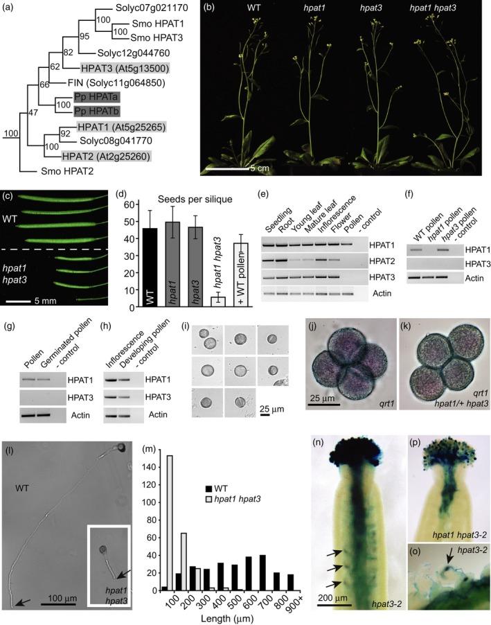 https://cdn.ncbi.nlm.nih.gov/pmc/blobs/2a80/4738400/e483666169b3/TPJ-85-193-g001.jpg