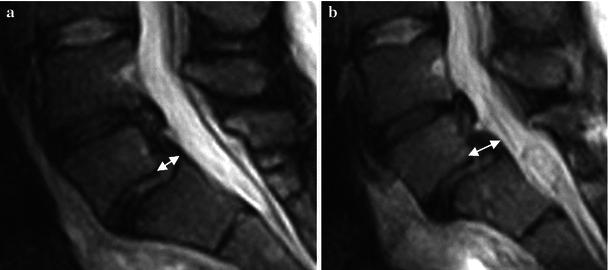 https://cdn.ncbi.nlm.nih.gov/pmc/blobs/2a85/4417871/82056e105f60/10195_2012_213_Fig10_HTML.jpg
