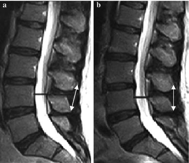 https://cdn.ncbi.nlm.nih.gov/pmc/blobs/2a85/4417871/92c4fb4a869e/10195_2012_213_Fig3_HTML.jpg