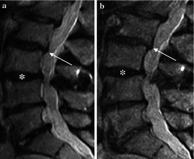 https://cdn.ncbi.nlm.nih.gov/pmc/blobs/2a85/4417871/9eab7326a95e/10195_2012_213_Fig8_HTML.jpg