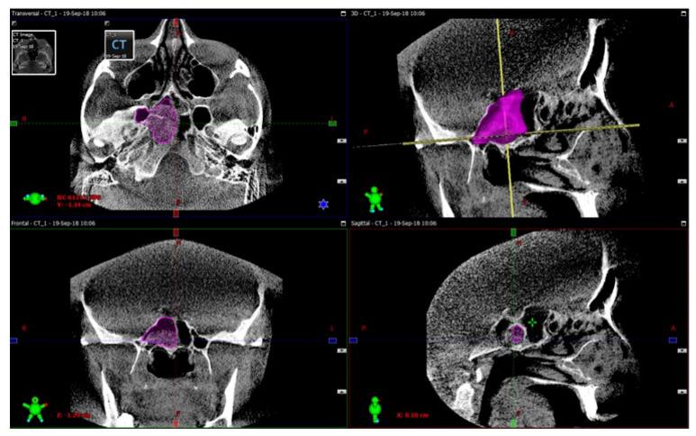https://cdn.ncbi.nlm.nih.gov/pmc/blobs/2a8f/7344634/33c2261f0f0e/diagnostics-10-00350-g001.jpg