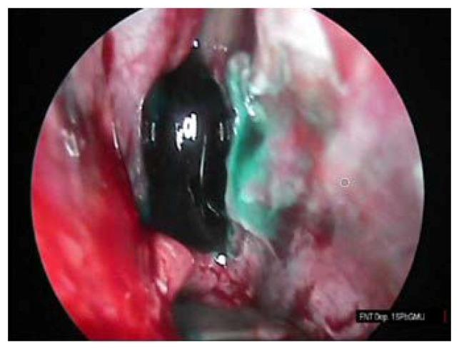 https://cdn.ncbi.nlm.nih.gov/pmc/blobs/2a8f/7344634/8bc925699c41/diagnostics-10-00350-g004.jpg