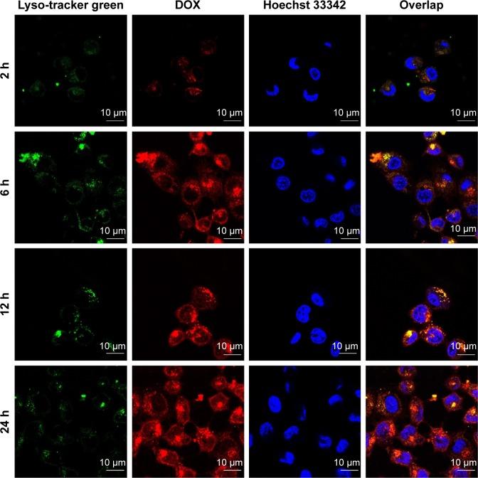 https://cdn.ncbi.nlm.nih.gov/pmc/blobs/2a99/5360411/0f1dbb0f7809/ijn-12-2081Fig6.jpg