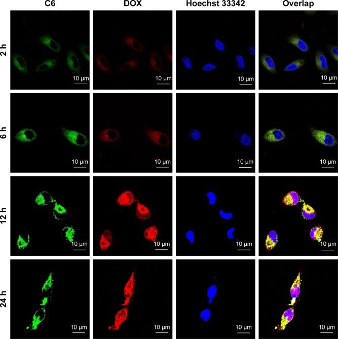 https://cdn.ncbi.nlm.nih.gov/pmc/blobs/2a99/5360411/1f2e24e6d704/ijn-12-2081Fig5.jpg