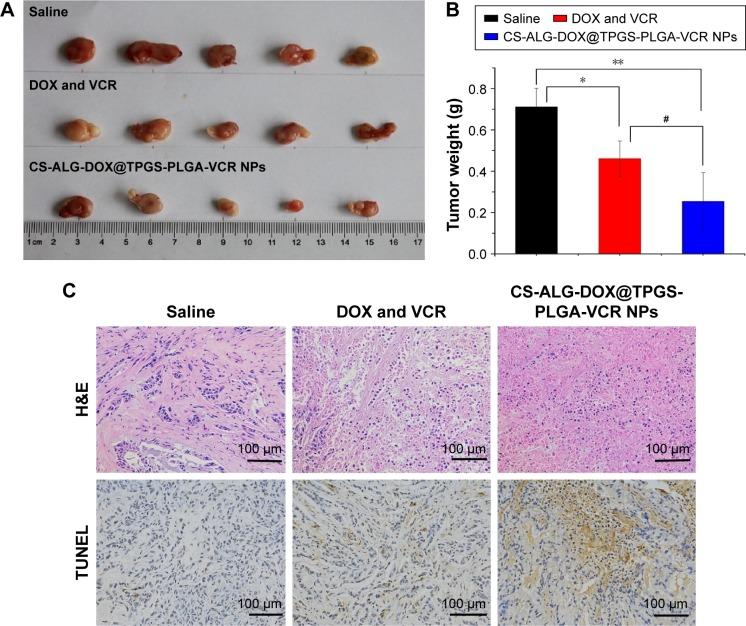 https://cdn.ncbi.nlm.nih.gov/pmc/blobs/2a99/5360411/fc2a7ee61384/ijn-12-2081Fig8.jpg