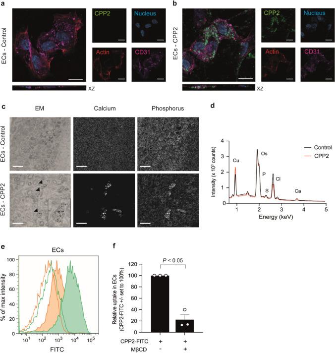 https://cdn.ncbi.nlm.nih.gov/pmc/blobs/2aa2/12033162/6a45d9621453/18_2025_5702_Fig2_HTML.jpg