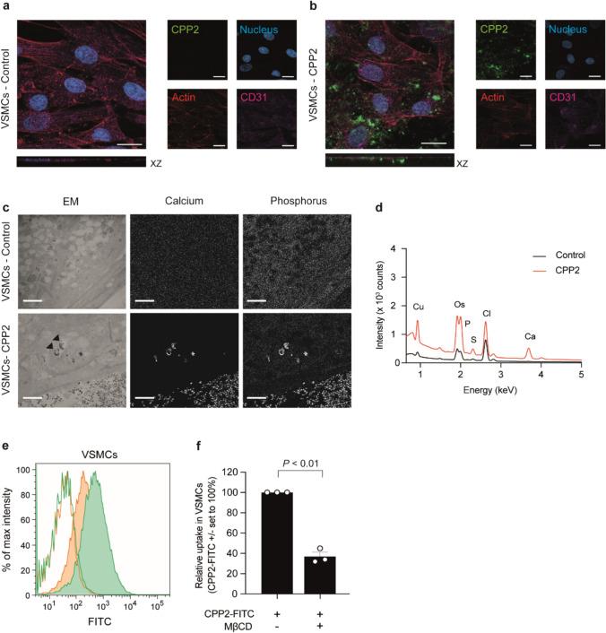https://cdn.ncbi.nlm.nih.gov/pmc/blobs/2aa2/12033162/ca5b9cd5354a/18_2025_5702_Fig3_HTML.jpg