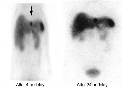 https://cdn.ncbi.nlm.nih.gov/pmc/blobs/2aa2/2877224/2a0ba5befff8/jkms-25-953-g002.jpg