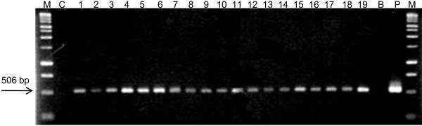 https://cdn.ncbi.nlm.nih.gov/pmc/blobs/2aa2/3111370/be81a22f9bbb/1471-2229-11-92-8.jpg