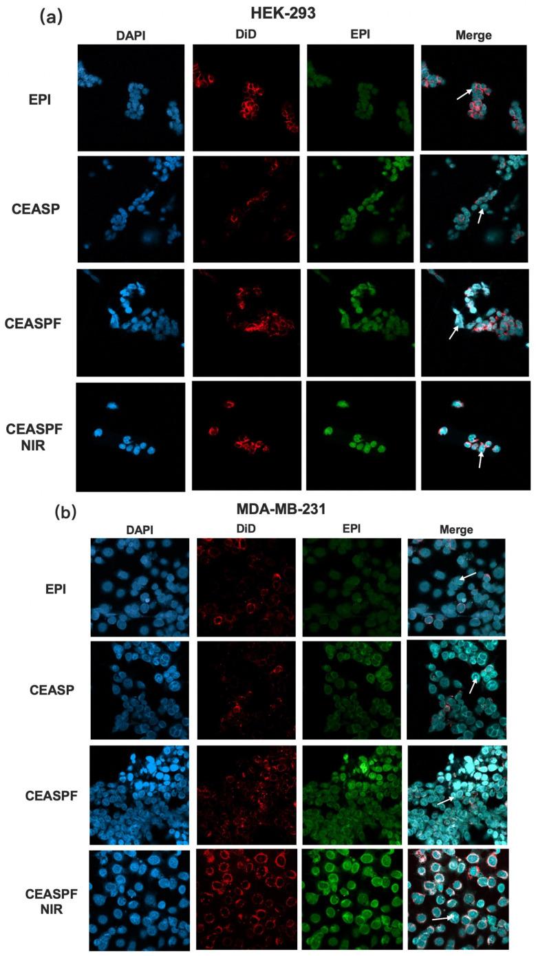 https://cdn.ncbi.nlm.nih.gov/pmc/blobs/2aa5/11820260/4a34b14bf005/nanomaterials-15-00221-g009.jpg
