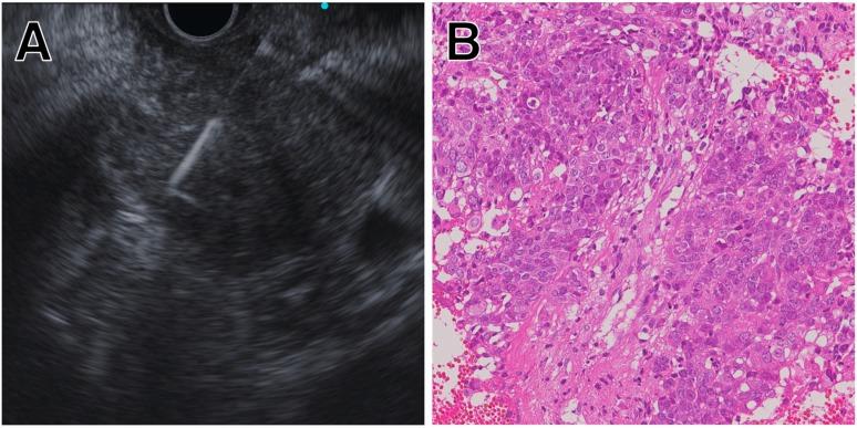 https://cdn.ncbi.nlm.nih.gov/pmc/blobs/2aa6/6723875/7a5ec1ba659c/jcm-08-01173-g002.jpg