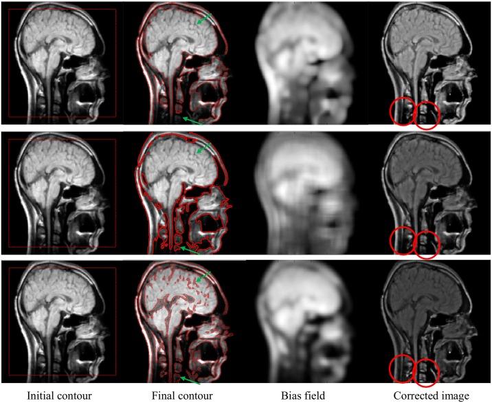 https://cdn.ncbi.nlm.nih.gov/pmc/blobs/2aa7/5380353/281d285e22ee/pone.0174813.g006.jpg