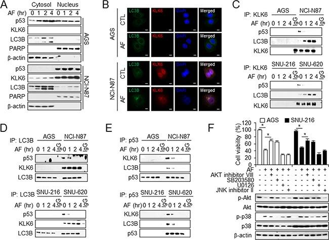 https://cdn.ncbi.nlm.nih.gov/pmc/blobs/2aae/5356740/373185f1e13e/oncotarget-07-85332-g006.jpg