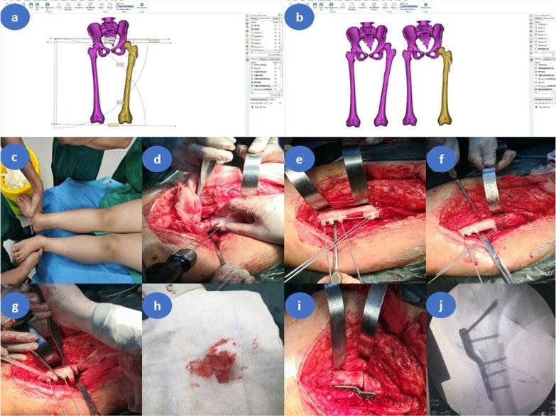 https://cdn.ncbi.nlm.nih.gov/pmc/blobs/2ab2/10124023/a49a4143588e/13018_2023_3801_Fig2_HTML.jpg