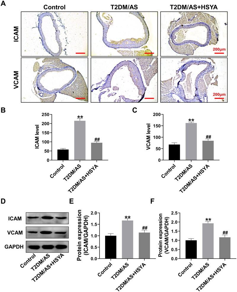 https://cdn.ncbi.nlm.nih.gov/pmc/blobs/2ac5/10327525/d01c5f2b510b/IPHB_A_2225543_F0002_C.jpg