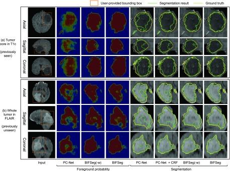 https://cdn.ncbi.nlm.nih.gov/pmc/blobs/2ac6/6051485/2684174b783d/wang11ab-2791721.jpg