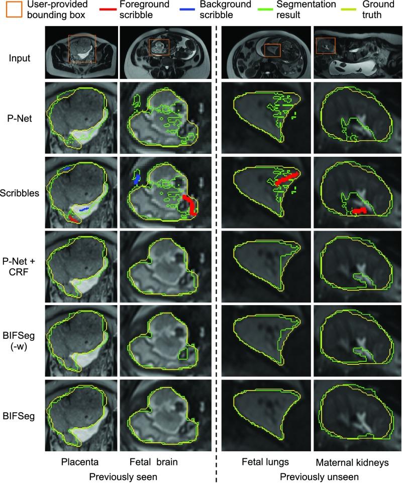 https://cdn.ncbi.nlm.nih.gov/pmc/blobs/2ac6/6051485/73d4b797a2b5/wang7-2791721.jpg