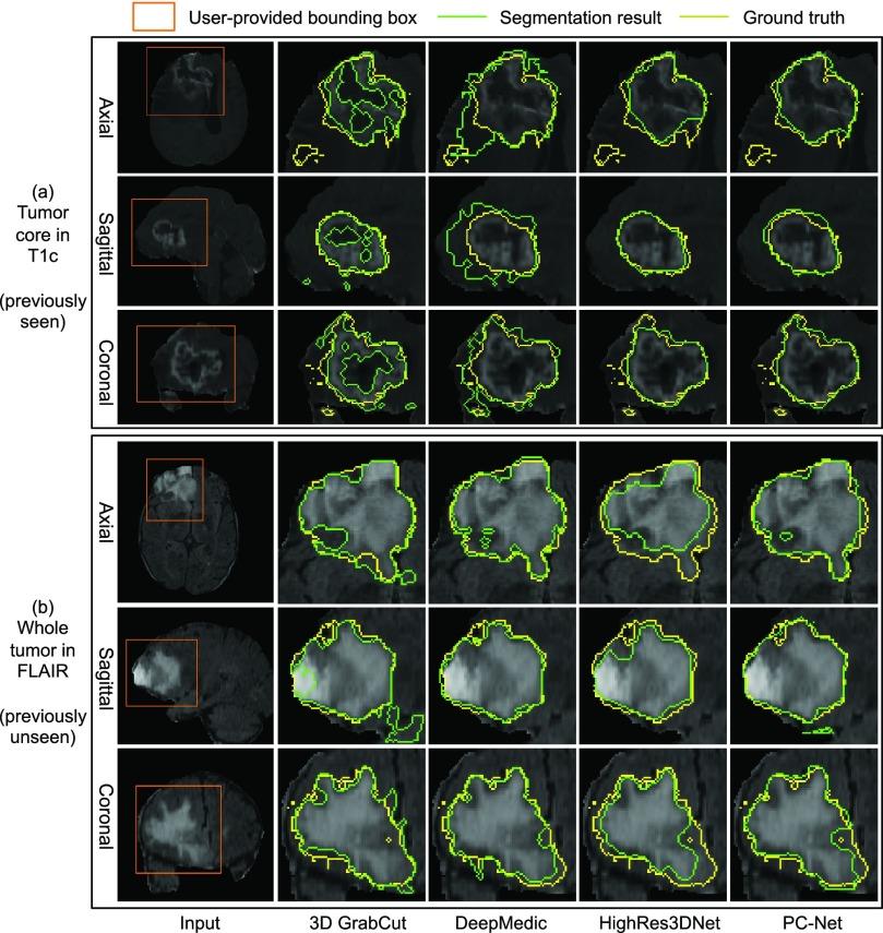 https://cdn.ncbi.nlm.nih.gov/pmc/blobs/2ac6/6051485/a35dc03cd102/wang10-2791721.jpg