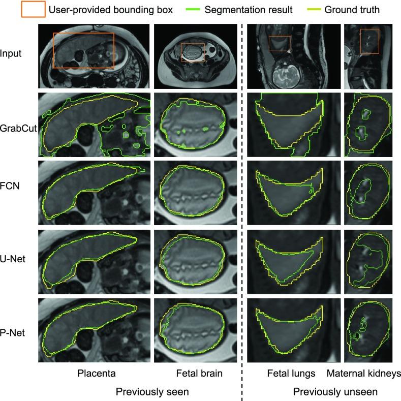 https://cdn.ncbi.nlm.nih.gov/pmc/blobs/2ac6/6051485/a9e4b667284d/wang5-2791721.jpg