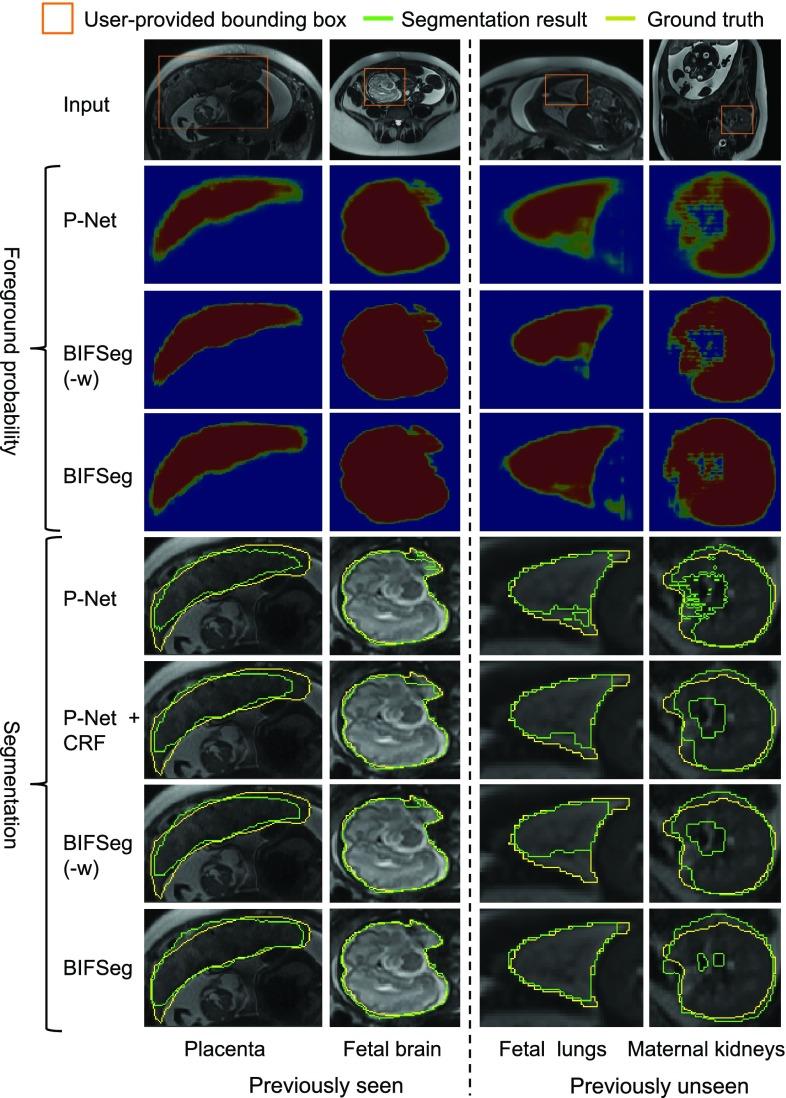 https://cdn.ncbi.nlm.nih.gov/pmc/blobs/2ac6/6051485/eaa850d09f53/wang6-2791721.jpg