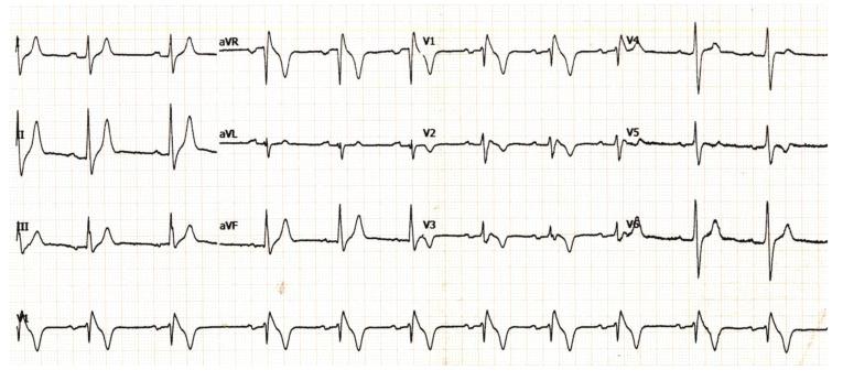https://cdn.ncbi.nlm.nih.gov/pmc/blobs/2ac9/6367699/3556a78a2fec/CCR-15-30_F5.jpg