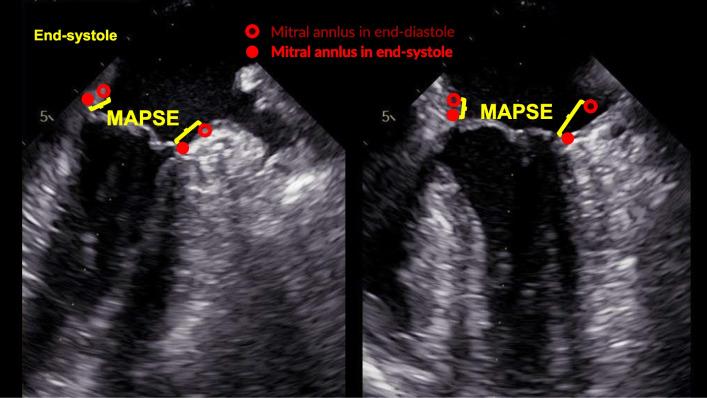 https://cdn.ncbi.nlm.nih.gov/pmc/blobs/2acf/11164841/3d70baeb57ee/40635_2024_640_Fig2_HTML.jpg