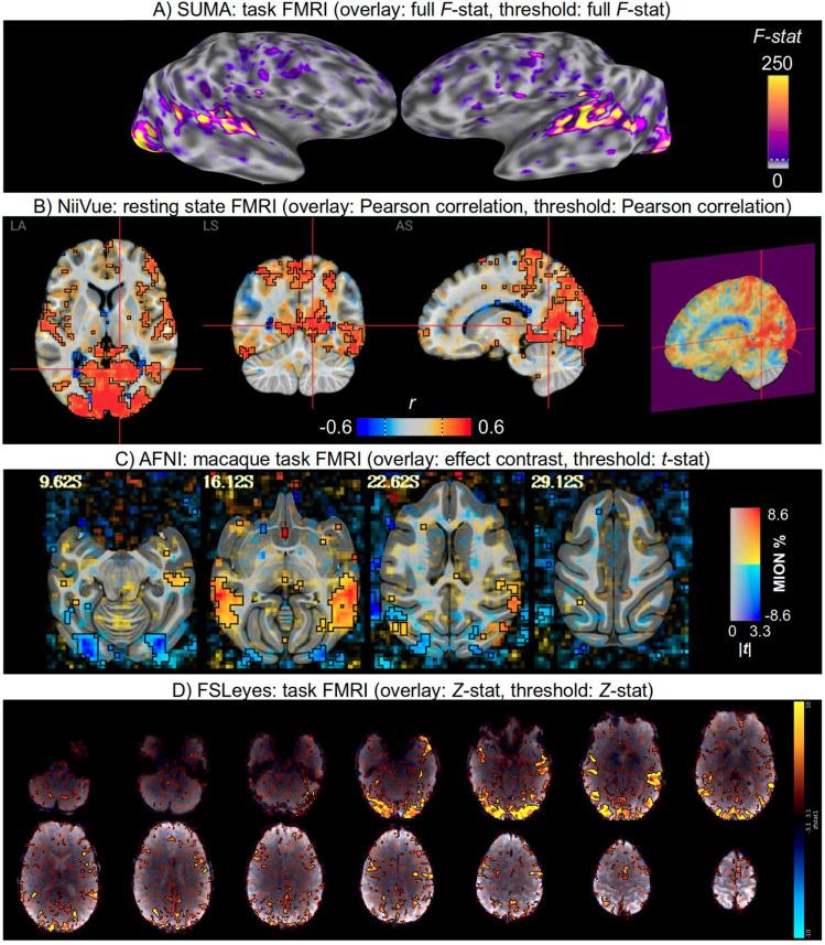 https://cdn.ncbi.nlm.nih.gov/pmc/blobs/2acf/12036441/26d3a1be6648/nihpp-2504.07824v1-f0005.jpg