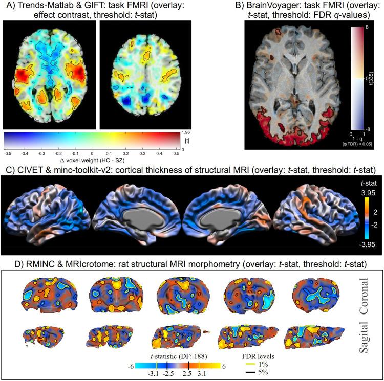 https://cdn.ncbi.nlm.nih.gov/pmc/blobs/2acf/12036441/60c4aac964dc/nihpp-2504.07824v1-f0006.jpg