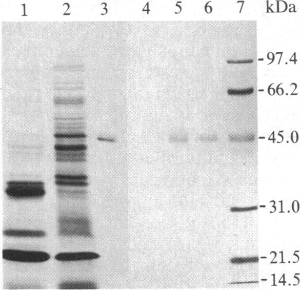 https://cdn.ncbi.nlm.nih.gov/pmc/blobs/2ad4/386515/c2c6b8a0cda6/pnas00321-0198-a.jpg