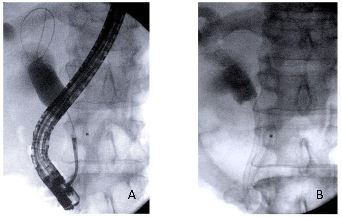 https://cdn.ncbi.nlm.nih.gov/pmc/blobs/2ad5/8997048/29733fb14ac3/cancers-14-01730-g003.jpg
