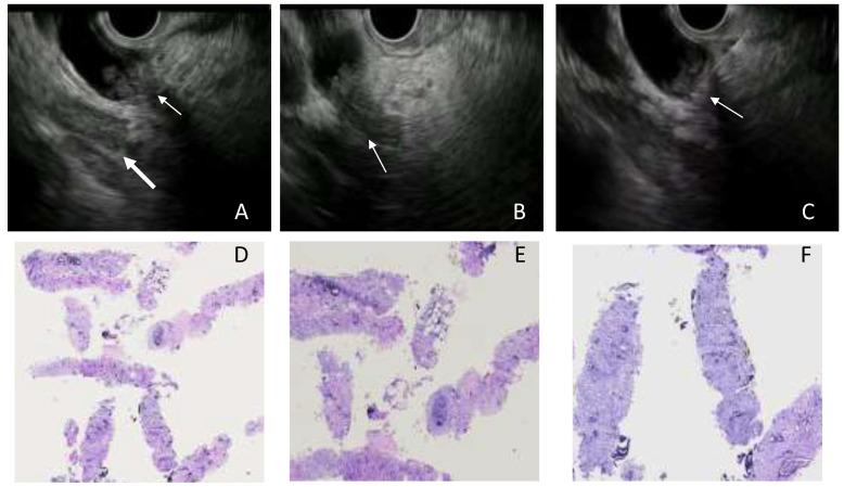 https://cdn.ncbi.nlm.nih.gov/pmc/blobs/2ad5/8997048/9711fe4a99b6/cancers-14-01730-g002.jpg