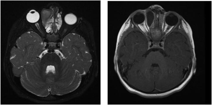https://cdn.ncbi.nlm.nih.gov/pmc/blobs/2ad9/8113836/5d68d6187736/gr2.jpg
