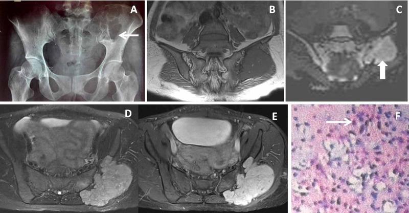 https://cdn.ncbi.nlm.nih.gov/pmc/blobs/2ade/7849915/8590157f3516/cureus-0013-00000012422-i08.jpg