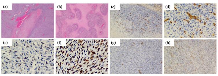 https://cdn.ncbi.nlm.nih.gov/pmc/blobs/2ae3/7698719/8d50e148ca7c/cancers-12-03417-g006.jpg