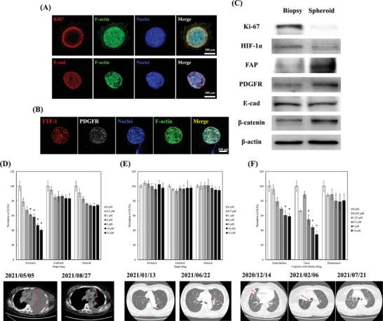 https://cdn.ncbi.nlm.nih.gov/pmc/blobs/2aec/10238206/198faf6b2891/ADVS-10-2206603-g003.jpg