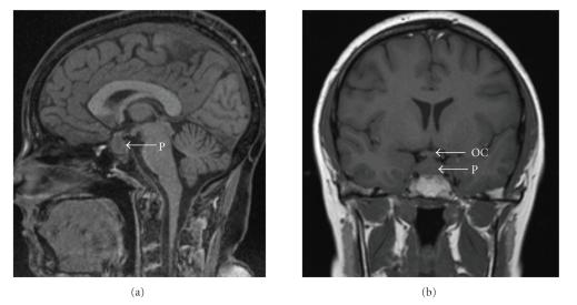 https://cdn.ncbi.nlm.nih.gov/pmc/blobs/2af0/2809337/325e7bb0ae67/IJR2009-346136.001.jpg