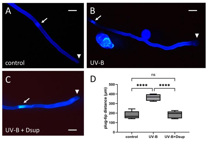 https://cdn.ncbi.nlm.nih.gov/pmc/blobs/2af2/11119994/4279123855b7/cells-13-00840-g007.jpg