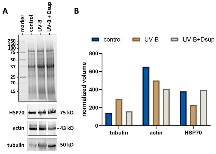 https://cdn.ncbi.nlm.nih.gov/pmc/blobs/2af2/11119994/78a45f861c91/cells-13-00840-g009.jpg