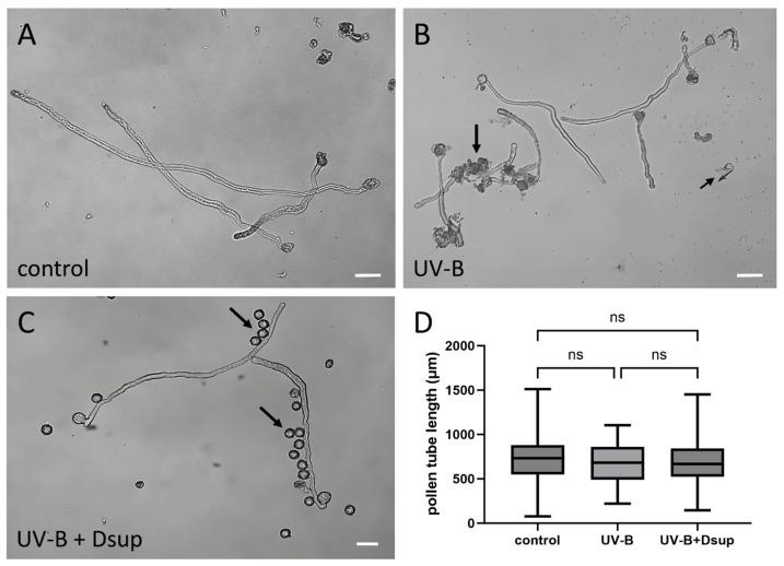 https://cdn.ncbi.nlm.nih.gov/pmc/blobs/2af2/11119994/e954fb9228da/cells-13-00840-g005.jpg