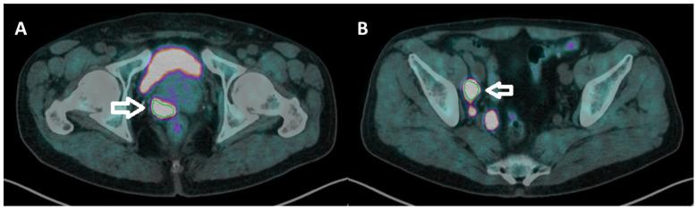 https://cdn.ncbi.nlm.nih.gov/pmc/blobs/2af3/9598779/d56939b979a7/biomedicines-10-02463-g001.jpg
