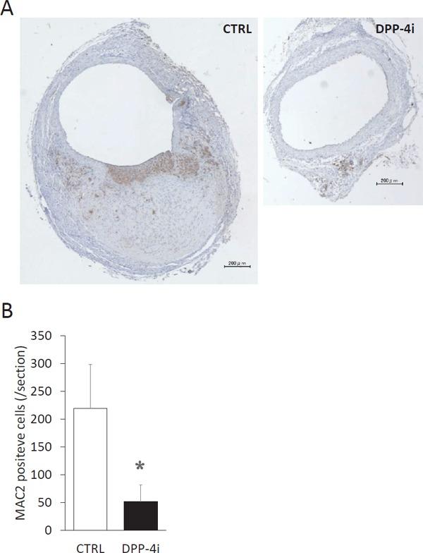 https://cdn.ncbi.nlm.nih.gov/pmc/blobs/2af5/6099070/3fe6898ed442/jat-25-698-g003.jpg