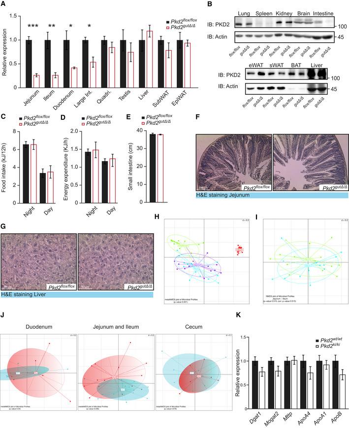https://cdn.ncbi.nlm.nih.gov/pmc/blobs/2af6/8103097/06d10226d173/EMMM-13-e13548-g009.jpg