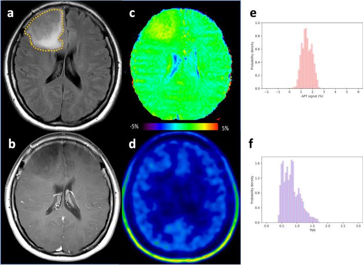 https://cdn.ncbi.nlm.nih.gov/pmc/blobs/2afa/11996729/66130fe80d56/41824_2025_248_Fig4_HTML.jpg
