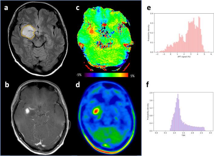 https://cdn.ncbi.nlm.nih.gov/pmc/blobs/2afa/11996729/f9c795d5da1e/41824_2025_248_Fig3_HTML.jpg