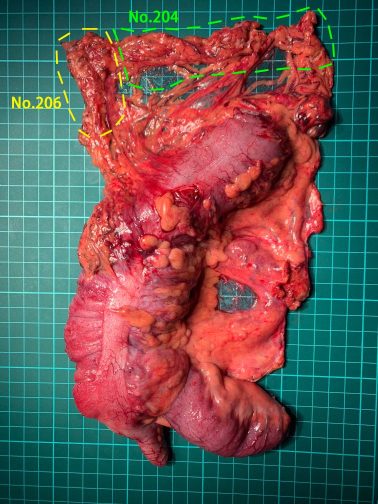 https://cdn.ncbi.nlm.nih.gov/pmc/blobs/2afa/9944796/3126c488ad74/bmjopen-2022-066981f04.jpg