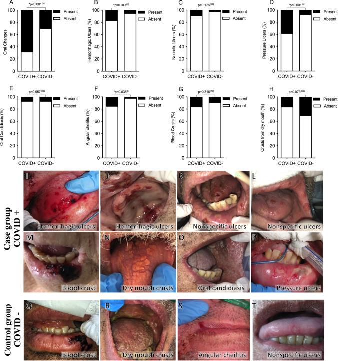 https://cdn.ncbi.nlm.nih.gov/pmc/blobs/2afd/10185958/157ee69b00b9/784_2023_5070_Fig1_HTML.jpg