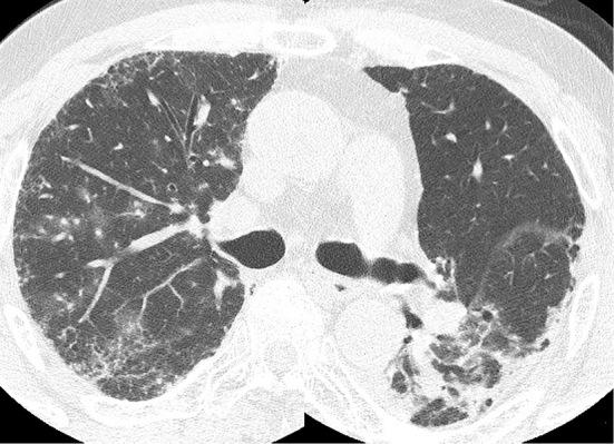 https://cdn.ncbi.nlm.nih.gov/pmc/blobs/2afd/5140863/5985602dd2ae/1349-7235-55-3143-g002.jpg