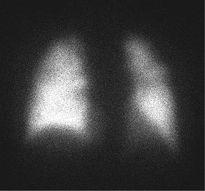 https://cdn.ncbi.nlm.nih.gov/pmc/blobs/2afd/5140863/f2167a6f2668/1349-7235-55-3143-g003.jpg